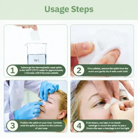 Nasal Stabilization Splint