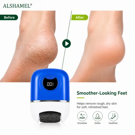 Electric Foot Grinder